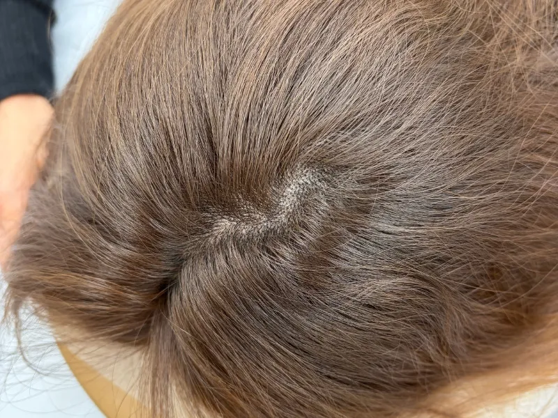 施術後：女性・分け目カバー、地肌目立たなく